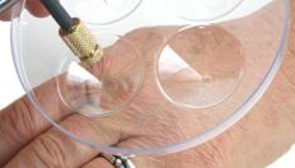 CryoPro Mini/Maxi Spr�hflasche